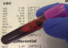 When do you need to get a CBC blood test done?