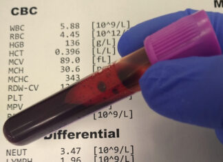 When do you need to get a CBC blood test done?