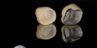 Dental Crowns and Bridges: An Overview Dental Crowns and Bridges