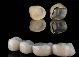Dental Crowns and Bridges: An Overview Dental Crowns and Bridges