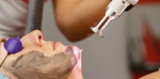 Carbon peel treatment in Dubai