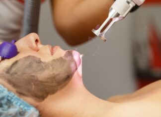 Carbon peel treatment in Dubai Carbon peel treatment in Dubai