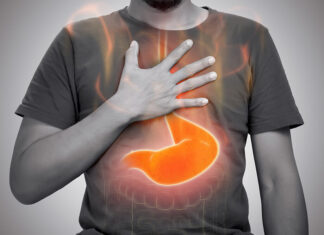 Management of Nighttime Gastroesophageal Reflux Disease Gastroesophageal Reflux Disease